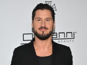 'Dancing With the Stars' pro Val Chmerkovskiy shares kidney stone photo