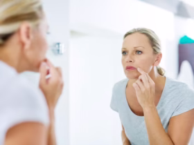 What Is Cortisol Face? The Truth About Stress and Facial Puffiness