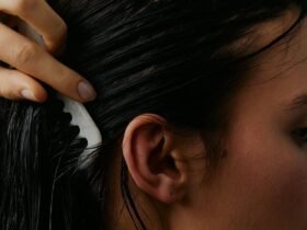 Thinning Hair at Your Temples? Experts Explain Why